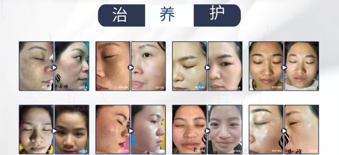通栏图片